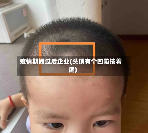 疫情期间过后企业(头顶有个凹陷按着疼)