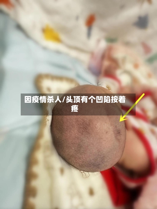 因疫情杀人/头顶有个凹陷按着疼